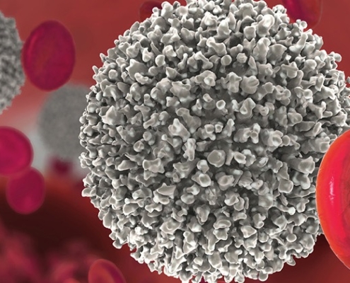 Lotta contro le leucemie: avanzi nella prevenzione e trattamento