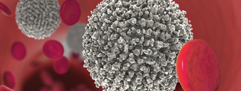 Lotta contro le leucemie: avanzi nella prevenzione e trattamento