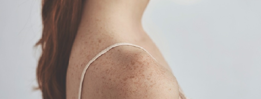 Lotta contro il melanoma: compiuto un passo avanti rivoluzionario