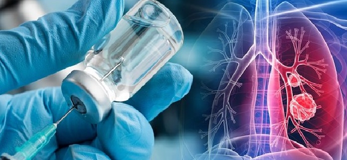 Nuovo vaccino mRNA contro cancro ai polmoni: avviati test