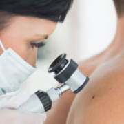 Melanoma: Italia sfida della prevenzione e investire sulla salute
