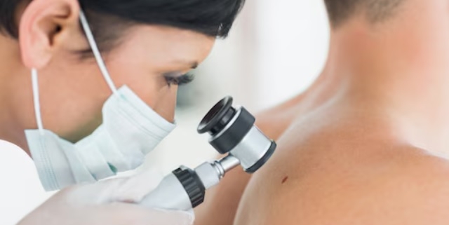 Melanoma: Italia sfida della prevenzione e investire sulla salute