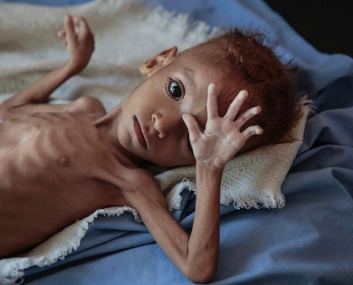 Il Natale che non arriva: quando la fame ruba l’infanzia. Il Natale, allora, non è solo una ricorrenza da celebrare, ma uno specchio scomodo.