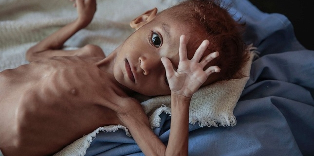 Il Natale che non arriva: quando la fame ruba l’infanzia. Il Natale, allora, non è solo una ricorrenza da celebrare, ma uno specchio scomodo.